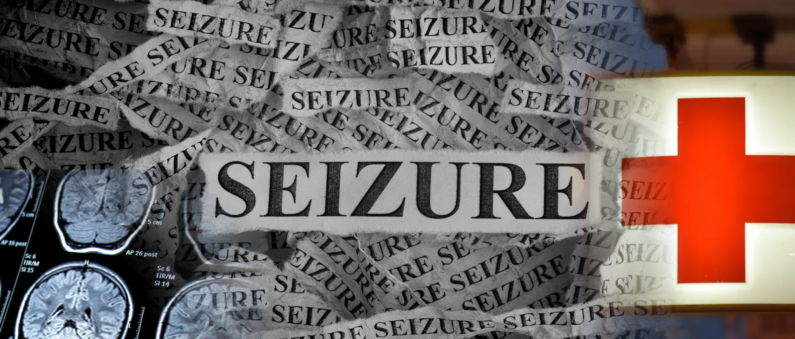 Seizures in Infants: What New Parents Need to Know